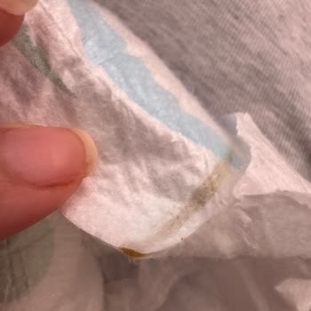Molfix Mega Bebek Bezinde Kahverengi Birikinti Ve Güven Kaybı
