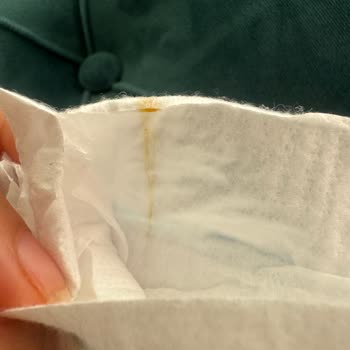 Molfix Mega Bebek Bezinde Kahverengi Birikinti Ve Güven Kaybı