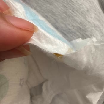 Molfix Mega Bebek Bezinde Kahverengi Birikinti Ve Güven Kaybı