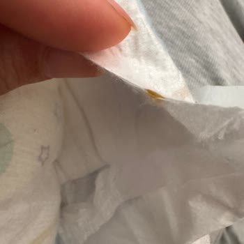 Molfix Mega Bebek Bezinde Kahverengi Birikinti Ve Güven Kaybı
