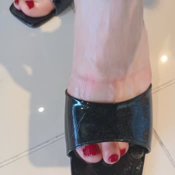 Novellam Shoes Terliği Ayağımda İz Bıraktı Ve İade Talebim Haksız Reddedildi
