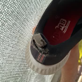 Skechers Ayakkabısında Tekrarlayan Topuk Deformasyonu Ve Tutarsız Servis Kararı
