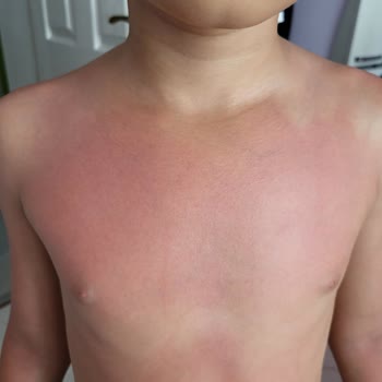Tokalon Güneş Kremi Hiçbir Koruma Sağlamadı