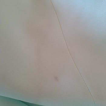 Kusurlu Elbiseler Ve İade Talebi 3.000 TL Geri Ödeme