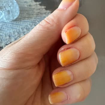 Flormar Ojesi Tırnaklarda Sararma Yaratıyor, Yanıt Alamıyorum