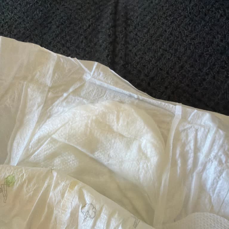 Sleepy Natural Bebek Bezinde Şişlik Ve Hijyen Güvenliği Sorunu
