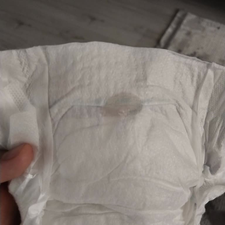 Molfix Bebek Bezinde Silikon Benzeri Katman Sorunu Ve Sağlık Riski