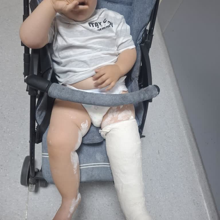 Çocukta Kırık Gözden Kaçırıldı, Hastane İhmaline Karşı Maddi Ve Manevi Şikayet