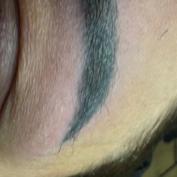 Lacivert Renkli Kaş Microblading Sonrası Kalitesiz Boya Şikayeti