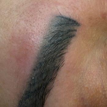 Lacivert Renkli Kaş Microblading Sonrası Kalitesiz Boya Şikayeti