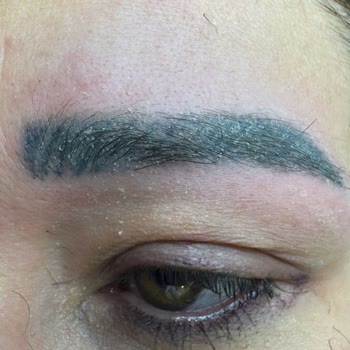 Lacivert Renkli Kaş Microblading Sonrası Kalitesiz Boya Şikayeti