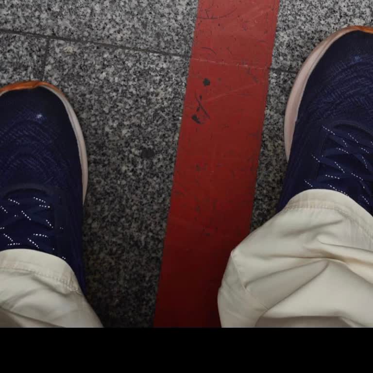 Skechers Ayakkabısında Kısa Sürede Yırtılma Ve Deformasyon Sorunu