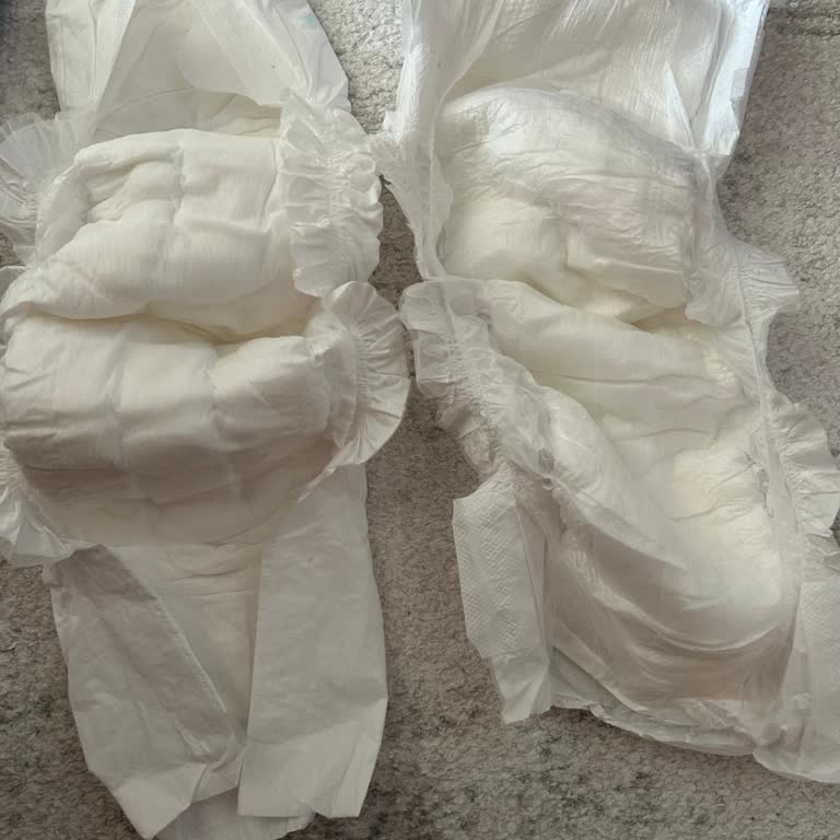 Kaliteli Bezde Beklenmedik Kızarıklık Ve Güven Sorunu