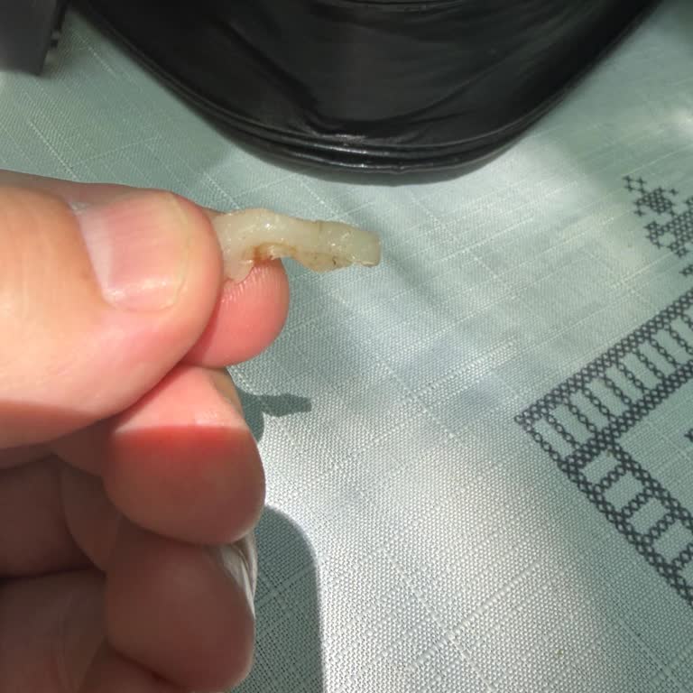 Pastada Sert Plastik Parça Çocuğumun Boğazına Neredeyse Takıldı