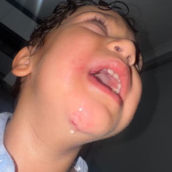Alarmın Ses Çıkması Ve Personelin Tutarsız Yaklaşımı Aile Güvenini Sarsıyor