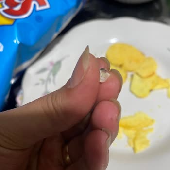 Ruffles Cipsinde Sert Yabancı Cisim Çocuğumu Tehlikeye Attı