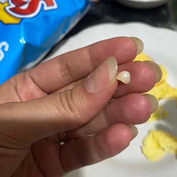 Ruffles Cipsinde Sert Yabancı Cisim Çocuğumu Tehlikeye Attı