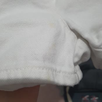 LCW Kids Şortu Üzerindeki Küf Lekesi Ve Hijyen Sorunu