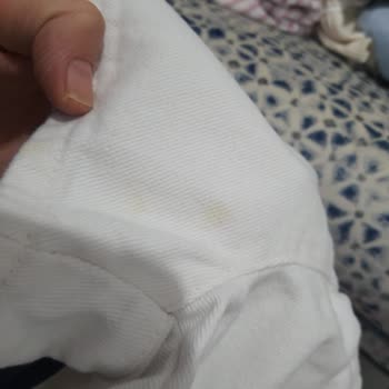 LCW Kids Şortu Üzerindeki Küf Lekesi Ve Hijyen Sorunu