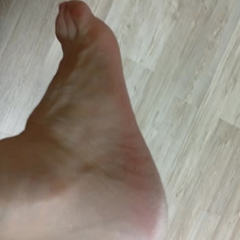 Ayaklarımı Boyayan Ugg Terliği İçin Geri Ödeme Talebi