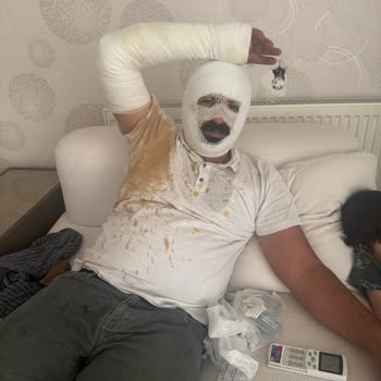 Motor Yağı Ve Soğutma Sistemindeki Arıza Nedeniyle Yanık Ve Garanti Reddi
