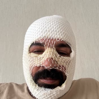 Motor Yağı Ve Soğutma Sistemindeki Arıza Nedeniyle Yanık Ve Garanti Reddi
