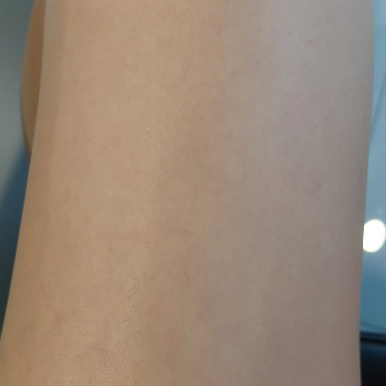 Medica Derma Sultanbeyli Şubesinde Bozuk Cihaz ve İlgisiz Personel