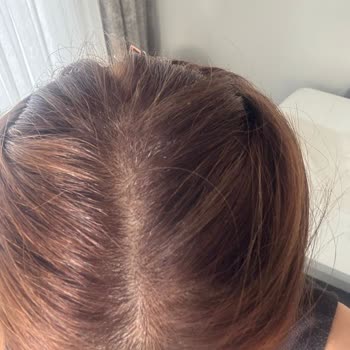 Salon Serenity Saç Sağlığım Bozuldu Ve Hem Param Hem De Zamanım Boşa Gitti