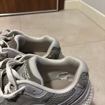 Erken Yırtılan Skechers Ayakkabısı, Sorumluluk Reddi Ve Telefon Kesilmesi