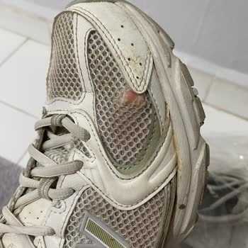 Sneaks Up 5.000 TL İade Talebi: New Balance 530 Yan File 6 Ayda Yırtıldı
