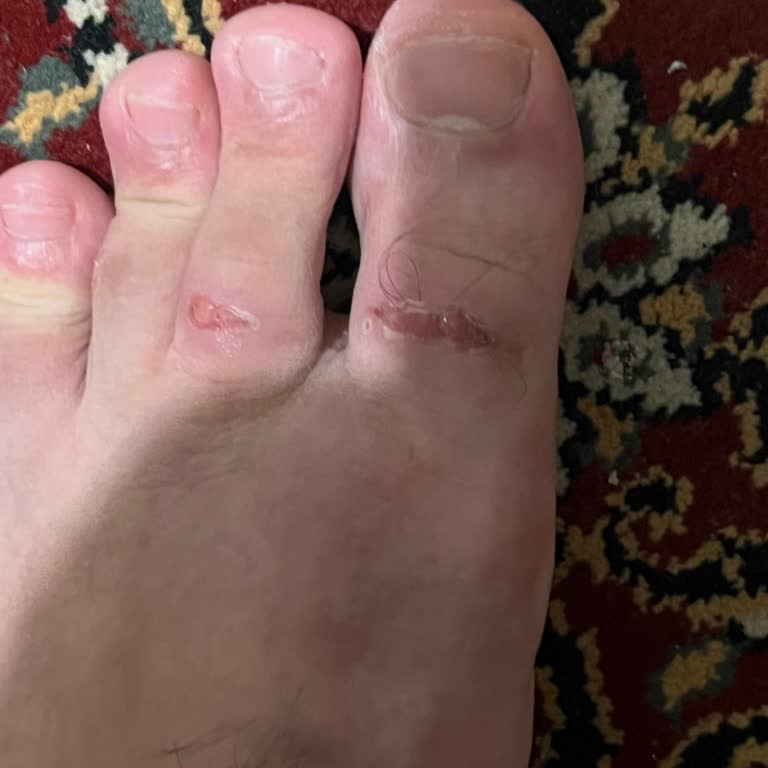 U.S. Polo Terliğinin Keskin Kenarı Ayak Yaralanmasına Neden Oldu, Değişim Talebi