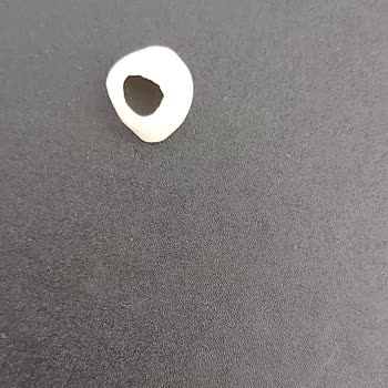 Özbudent Ağız Ve Diş Sağlığı Polikliniği Pendik Şubesinde Hatalı Kanal Tedavisi Ve Kırılan Kaplama Nedeniyle 12.000 TL İadesi Talebi