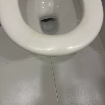 Banyo Ve Tuvalet Hijyeninde Yetersiz Temizlik Ve İlgisiz Personel