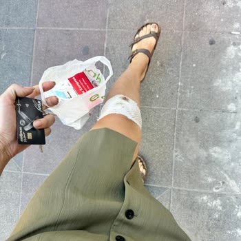 Mango Mağazasında Düşme Sonrası İlgisiz Yaklaşım Ve Tazmin Talebi
