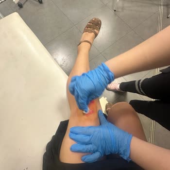 Mango Mağazasında Düşme Sonrası İlgisiz Yaklaşım Ve Tazmin Talebi