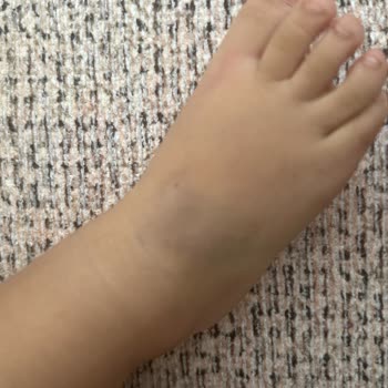 Medihaus Cerrahi Tıp Merkezi'nde Bebek Sünnetinde Damar Yolu Açma Konusundaki Yetersiz Hemşirelik