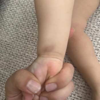 Medihaus Cerrahi Tıp Merkezi'nde Bebek Sünnetinde Damar Yolu Açma Konusundaki Yetersiz Hemşirelik