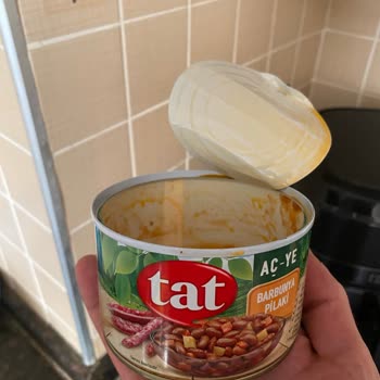 Taş İçeren Konserve Üründe Diş Kırılması