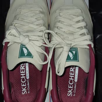 Skechers Ayakkabısının İç Çürümesi Garanti Kapsamında Reddedildi
