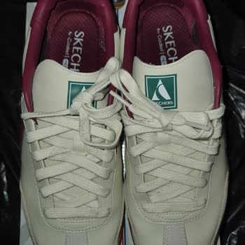 Skechers Ayakkabısının İç Çürümesi Garanti Kapsamında Reddedildi