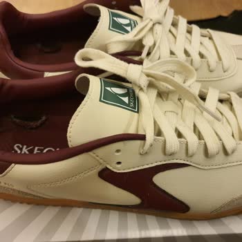 Skechers Ayakkabısının İç Çürümesi Garanti Kapsamında Reddedildi