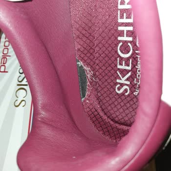 Skechers Ayakkabısının İç Çürümesi Garanti Kapsamında Reddedildi