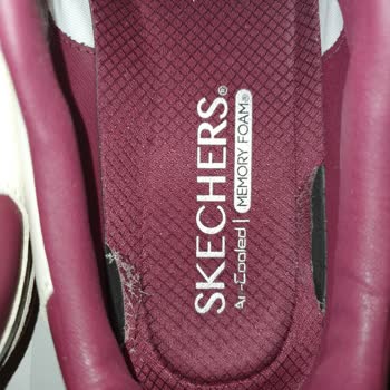 Skechers Ayakkabısının İç Çürümesi Garanti Kapsamında Reddedildi
