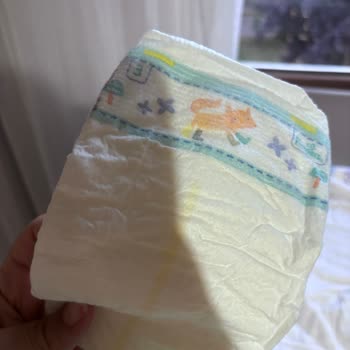 Eski Tasarım Bebek Bezi Ve Kaka Kaçağı Problemi