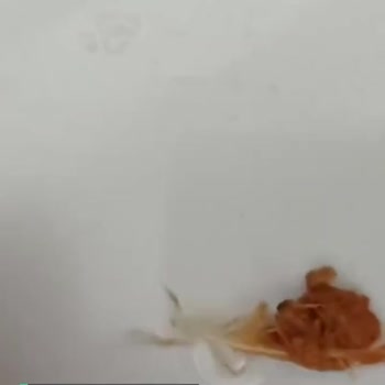 Hastavuk Döner Paketi İçinde Tavuk Tüyü Çıktı