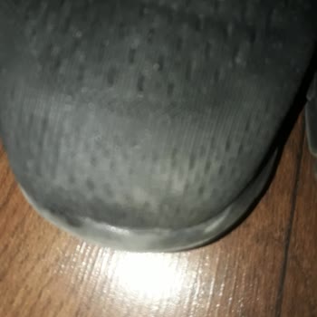 Skechers Ayakkabısının Kısa Sürede Yırtılması Ve Mağaza Tarafından Müşteri Hatası İddiası