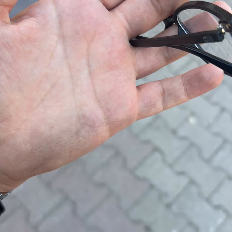 Şoförünün Dikkatsiz Hızlanması Beni Düşürdü Ve Yardım Etmedi