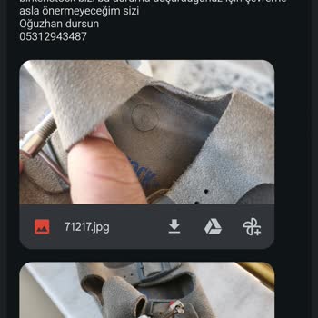 Birkenstock Terliği Tekrarlayan Yara Sorunu Ve Ücret İadesi Talebi