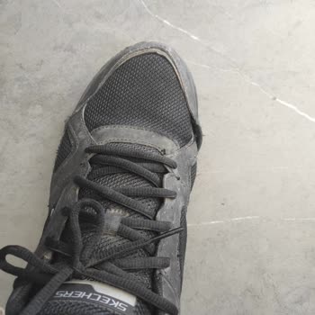 Skechers Ayakkabısının Dikişlerinin Erken Kopması Ve Mağaza Tarafından Kullanıcı Hatası İddiası
