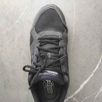 Skechers Ayakkabısının Dikişlerinin Erken Kopması Ve Mağaza Tarafından Kullanıcı Hatası İddiası